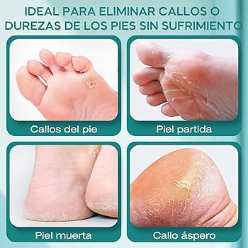 PedicurePro™ + ENVÍO GRATIS🎁